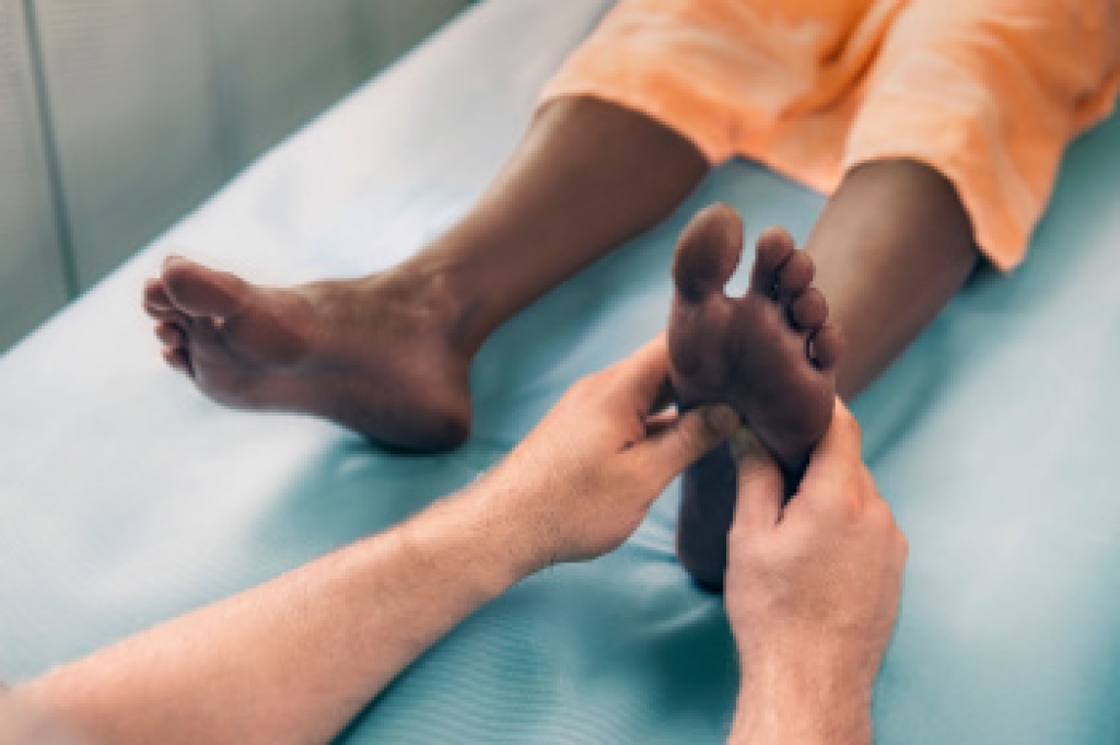 How Rheumatoid Arthritis Affects the Feet